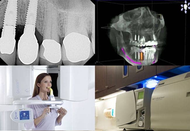 dental implants Newtown